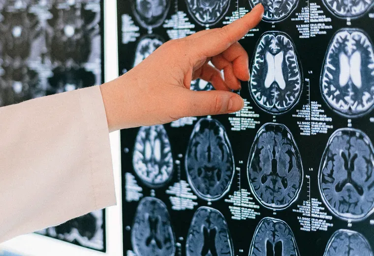 Neurology